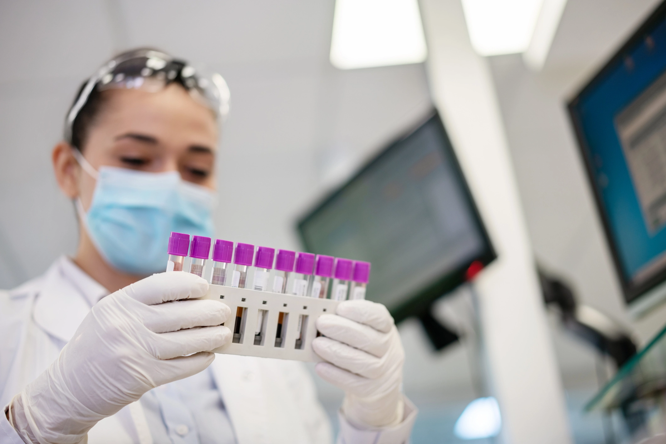 sample management